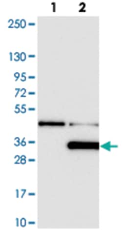LYPLAL1, Rabbit, Polyclonal Antibody, Abnova 100&mu;L; Unlabeled:Antibodies,