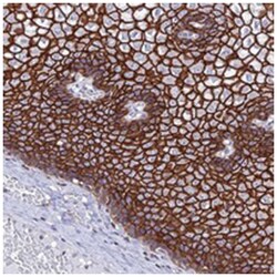 S100A16 Rabbit anti-Human, Polyclonal Antibody, Abnova 100&mu;L; Unlabeled:Antibodies,