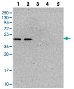 NSUN6, Rabbit, Polyclonal Antibody, Abnova 100 &mu;L | Buy Online | Abnova Corporation | Fisher Scientific