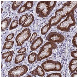 NSUN6, Rabbit, Polyclonal Antibody, Abnova 100 &mu;L | Buy Online | Abnova Corporation | Fisher Scientific