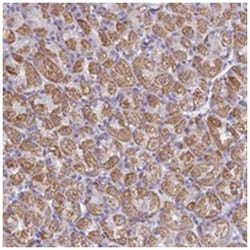 C1orf192, Rabbit, Polyclonal Antibody, Abnova 100 &mu;L | Buy Online | Abnova Corporation | Fisher Scientific