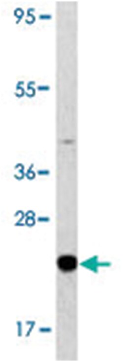 BAD Rabbit anti-Human, Polyclonal Antibody, Abnova 400 &mu;L | Buy Online | Abnova Corporation | Fisher Scientific