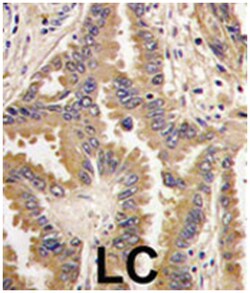BAD Rabbit anti-Human, Polyclonal Antibody, Abnova 400 &mu;L | Buy Online | Abnova Corporation | Fisher Scientific