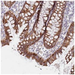C6orf223, Rabbit, Polyclonal Antibody, Abnova 100 &mu;L | Buy Online | Abnova Corporation | Fisher Scientific