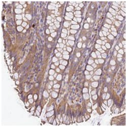 WDR64, Rabbit, Polyclonal Antibody, Abnova 100 &mu;L | Buy Online | Abnova Corporation | Fisher Scientific