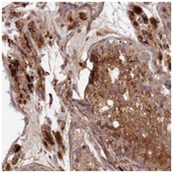 KIAA0528, Rabbit, Polyclonal Antibody, Abnova 100 &mu;L | Buy Online | Abnova Corporation | Fisher Scientific