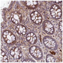 WIBG, Rabbit, Polyclonal Antibody, Abnova 100&mu;L; Unlabeled:Antibodies,