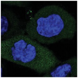 WIBG, Rabbit, Polyclonal Antibody, Abnova 100&mu;L; Unlabeled:Antibodies,