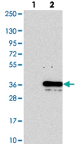 WIBG, Rabbit, Polyclonal Antibody, Abnova 100&mu;L; Unlabeled:Antibodies,