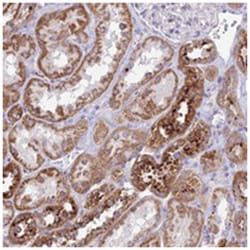 PNLIPRP3, Rabbit, Polyclonal Antibody, Abnova 100 &mu;L | Buy Online | Abnova Corporation | Fisher Scientific