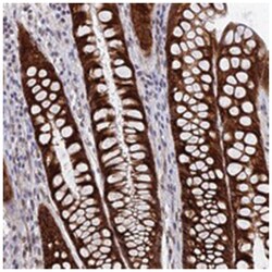 KATNAL1, Rabbit, Polyclonal Antibody, Abnova 100 &mu;L | Buy Online | Abnova Corporation | Fisher Scientific