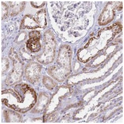 PRR13, Rabbit, Polyclonal Antibody, Abnova 100&mu;L; Unlabeled:Antibodies,