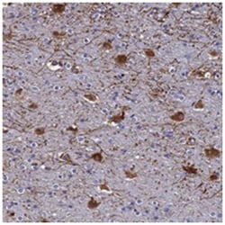 SYT13, Rabbit, Polyclonal Antibody, Abnova 100 &mu;L | Buy Online | Abnova Corporation | Fisher Scientific