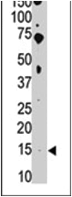 BIK Rabbit anti-Human, Mouse, Polyclonal Antibody, Abnova 400 &mu;L | Buy Online | Abnova Corporation | Fisher Scientific