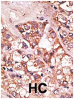 BIK Rabbit anti-Human, Mouse, Polyclonal Antibody, Abnova 400 &mu;L | Buy Online | Abnova Corporation | Fisher Scientific