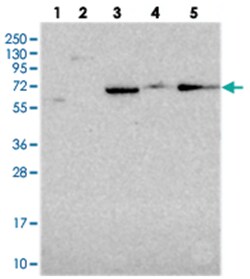 ALDH1A3, Rabbit, Polyclonal Antibody, Abnova 100&mu;L; Unlabeled:Antibodies,
