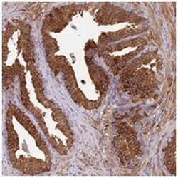 ALDH1A3, Rabbit, Polyclonal Antibody, Abnova 100&mu;L; Unlabeled:Antibodies,