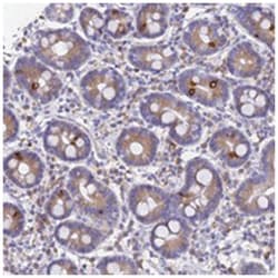 GNG13, Rabbit, Polyclonal Antibody, Abnova 100 &mu;L | Buy Online | Abnova Corporation | Fisher Scientific