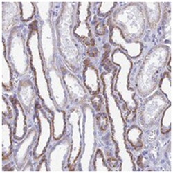 ACSM1, Rabbit, Polyclonal Antibody, Abnova 100 &mu;L | Buy Online | Abnova | Fisher Scientific