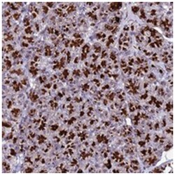 C19orf47 Rabbit anti-Human, Polyclonal Antibody, Abnova 100 &mu;L | Buy Online | Abnova Corporation | Fisher Scientific