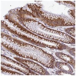 FAM160A1, Rabbit, Polyclonal Antibody, Abnova 100 &mu;L | Buy Online | Abnova Corporation | Fisher Scientific