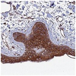 TMC2, Rabbit, Polyclonal Antibody, Abnova 100&mu;L; Unlabeled:Antibodies,