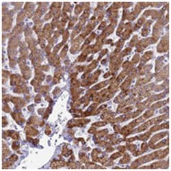 KNCN, Rabbit, Polyclonal Antibody, Abnova 100 &mu;L | Buy Online | Abnova Corporation | Fisher Scientific