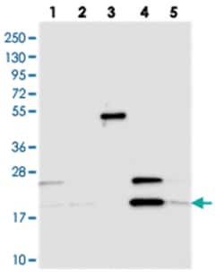 C3orf75, Rabbit, Polyclonal Antibody, Abnova 100 &mu;L | Buy Online | Abnova Corporation | Fisher Scientific