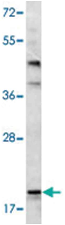 BAD Rabbit anti-Human, Mouse, Polyclonal Antibody, Abnova 400 &mu;L | Buy Online | Abnova Corporation | Fisher Scientific