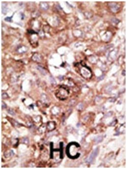 BAD Rabbit anti-Human, Mouse, Polyclonal Antibody, Abnova 400 &mu;L | Buy Online | Abnova Corporation | Fisher Scientific