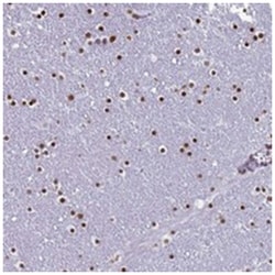 LCE6A, Rabbit, Polyclonal Antibody, Abnova 100 &mu;L | Buy Online | Abnova Corporation | Fisher Scientific