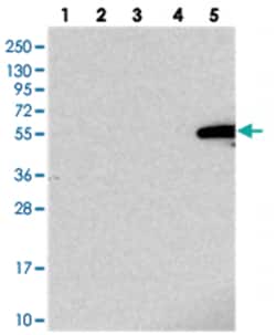 IGSF11, Rabbit, Polyclonal Antibody, Abnova 100&mu;L; Unlabeled:Antibodies,