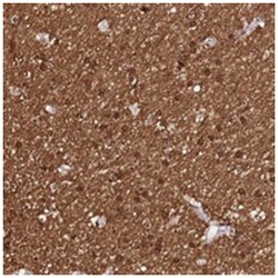 DEFB132, Rabbit, Polyclonal Antibody, Abnova 100 &mu;L | Buy Online | Abnova Corporation | Fisher Scientific
