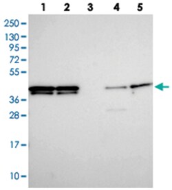HNRNPAB, Rabbit, Polyclonal Antibody, Abnova 100 &mu;L | Buy Online | Abnova Corporation | Fisher Scientific