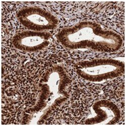 HNRNPAB, Rabbit, Polyclonal Antibody, Abnova 100 &mu;L | Buy Online | Abnova Corporation | Fisher Scientific