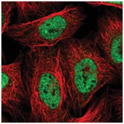 HNRNPAB, Rabbit, Polyclonal Antibody, Abnova 100 &mu;L | Buy Online | Abnova Corporation | Fisher Scientific