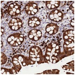 UQCRQ, Rabbit, Polyclonal Antibody, Abnova 100&mu;L; Unlabeled:Antibodies,