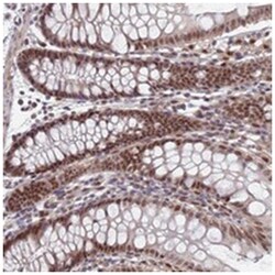 RPP25, Rabbit, Polyclonal Antibody, Abnova 100&mu;L; Unlabeled:Antibodies,