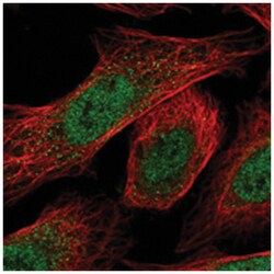 RPP25, Rabbit, Polyclonal Antibody, Abnova 100&mu;L; Unlabeled:Antibodies,