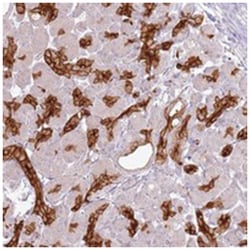 LIX1L, Rabbit, Polyclonal Antibody, Abnova 100 &mu;L | Buy Online | Abnova Corporation | Fisher Scientific