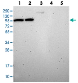 DDX27, Rabbit, Polyclonal Antibody, Abnova 100&mu;L; Unlabeled:Antibodies,