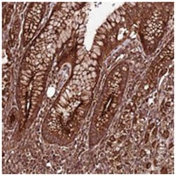 FAM186A, Rabbit, Polyclonal Antibody, Abnova 100 &mu;L | Buy Online | Abnova Corporation | Fisher Scientific