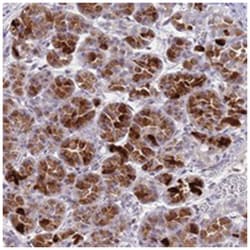 OR2T11, Rabbit, Polyclonal Antibody, Abnova 100 &mu;L | Buy Online | Abnova Corporation | Fisher Scientific