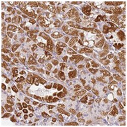 DEFB116, Rabbit, Polyclonal Antibody, Abnova 100 &mu;L | Buy Online | Abnova Corporation | Fisher Scientific