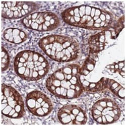 DUSP28, Rabbit, Polyclonal Antibody, Abnova 100&mu;L; Unlabeled:Antibodies,