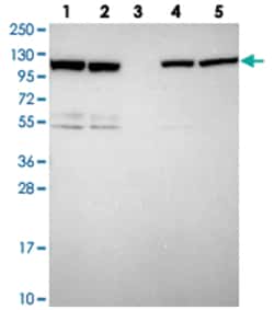 ZC3HAV1 Rabbit anti-Human, Polyclonal Antibody, Abnova 100&mu;L; Unlabeled:Antibodies,