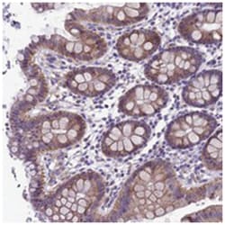 KIAA1407, Rabbit, Polyclonal Antibody, Abnova 100 &mu;L | Buy Online | Abnova Corporation | Fisher Scientific