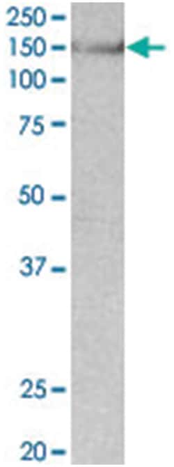 SYNGAP1 Goat anti-Mouse, Polyclonal Antibody, Abnova 100&mu;g; Unlabeled:Antibodies,