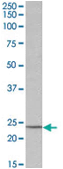 TIMP1, Goat, Polyclonal Antibody, Abnova 100 &mu;g | Buy Online | Abnova Corporation | Fisher Scientific