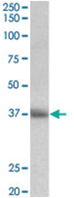 CD7, Goat, Polyclonal Antibody, Abnova 100 &mu;g | Buy Online | Abnova Corporation | Fisher Scientific